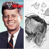 Hồ sơ mật: Bí ẩn bộ não biến mất của cựu Tổng thống Mỹ Kennedy