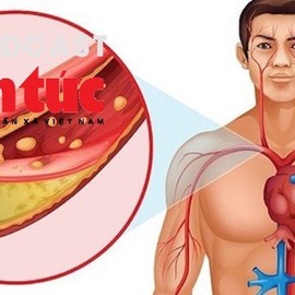 "Bác sĩ ơi' - Kiểm soát Cholesterol máu thế nào là đúng?